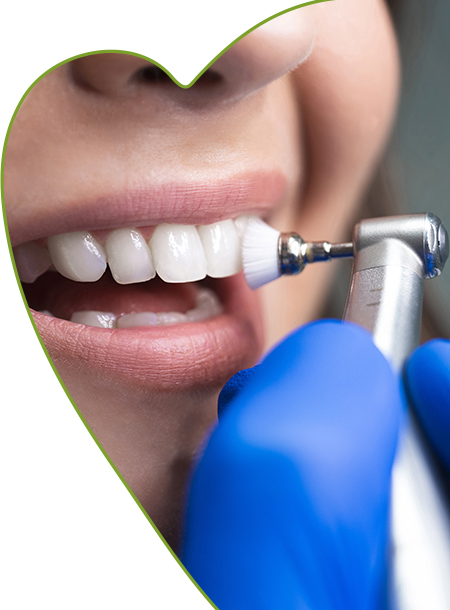 igiene dentale